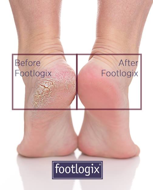 DX3NY5UXUAEPzGM (1) pedicume